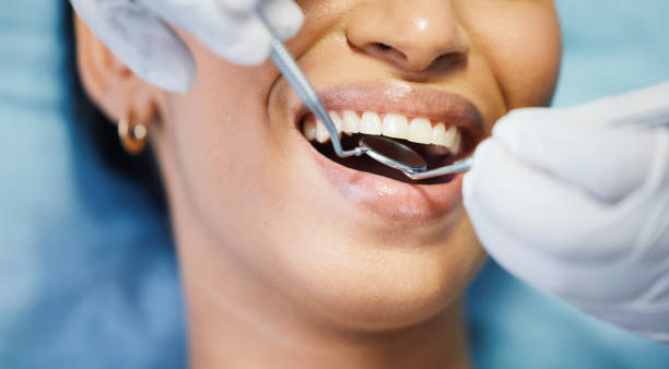 Best Emergency Treatment for Dental Infections or Abscesses in Crestline, CA